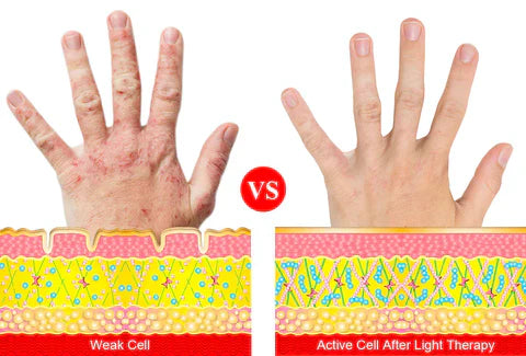ArthroGlow Near Infrared Hand Therapy Gloves for Arthritis