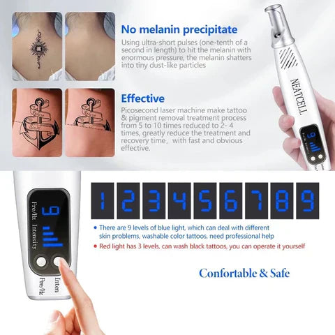 AstraGlow Home Laser Pen For Tattoo, Mole And Freckle Removal