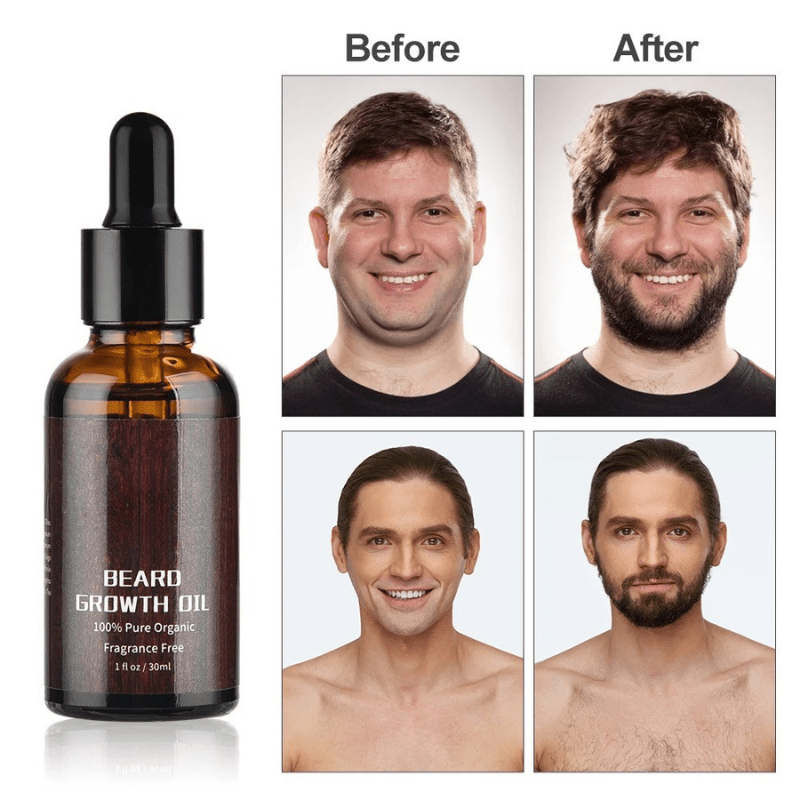 BARTBOOST – Beard Growth Kit for a Healthy & Strong Beard