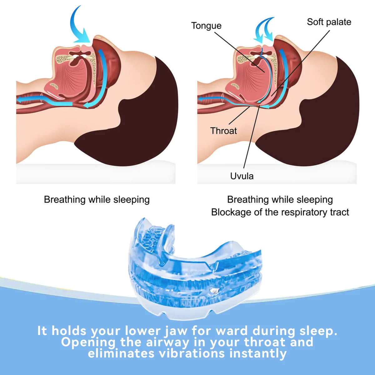 Charly | Adjustable Anti-Snoring Mouthguard Made of BPA-Free Material