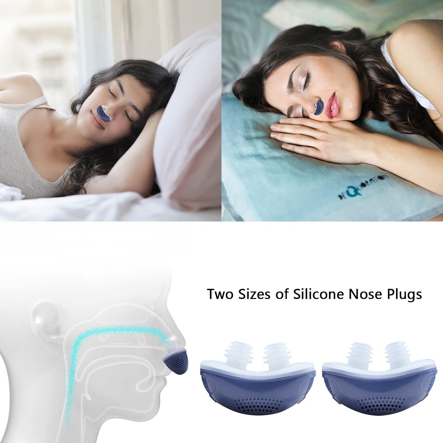 Charly | Anti-Snoring Device | Tubeless, Maskless Micro-CPAP
