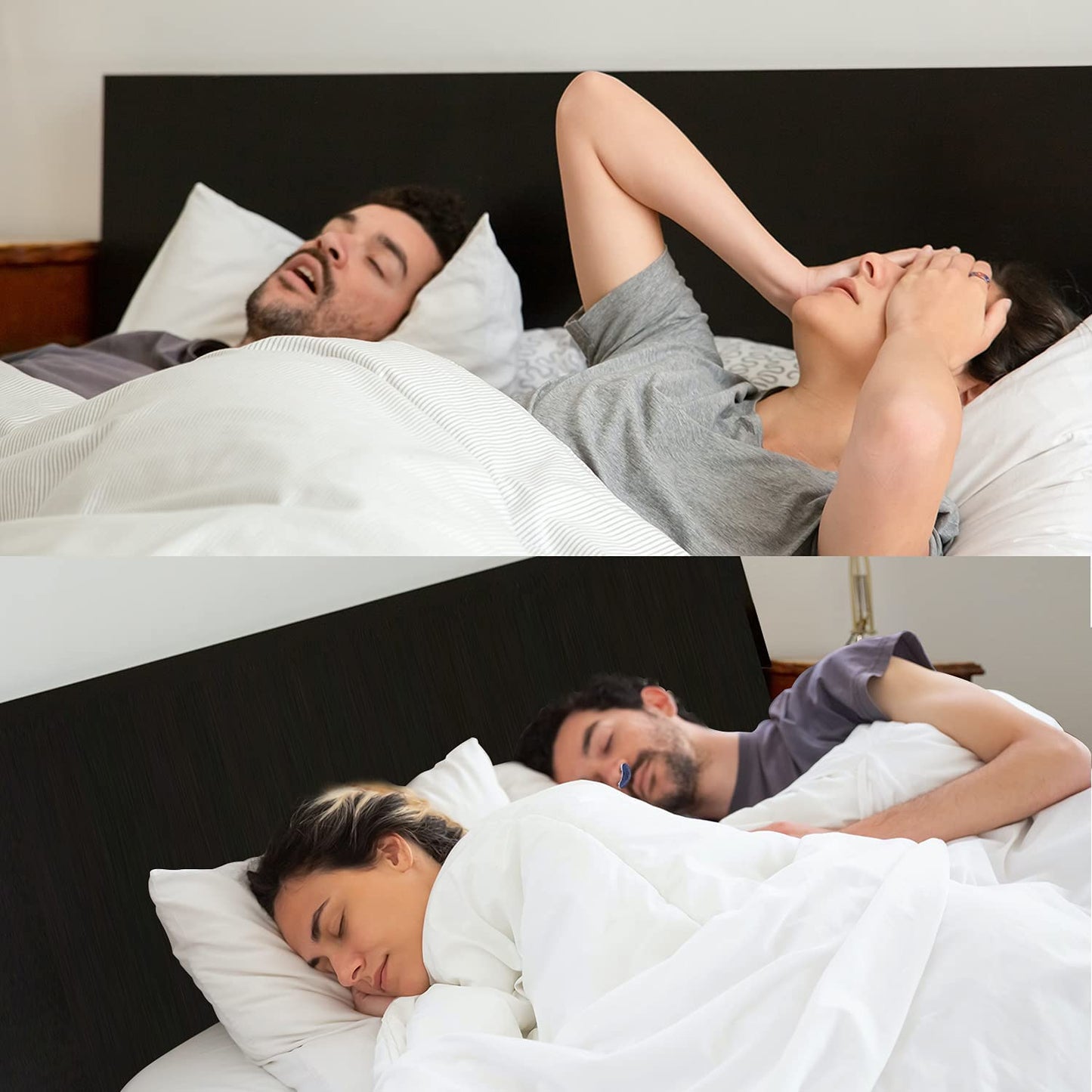 Charly | Anti-Snoring Device | Tubeless, Maskless Micro-CPAP