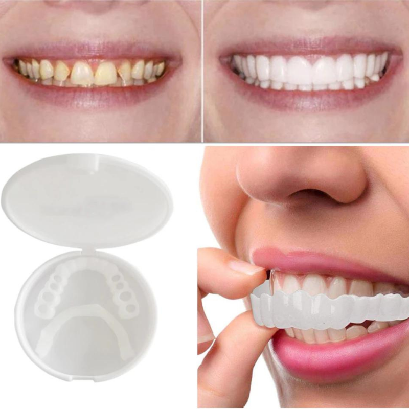 Charly | Cosmetic Dentures for a Natural Smile