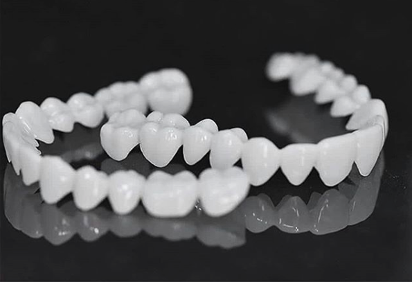 Charly | DentAlign Dental Veneers – Natural Fit and Comfort
