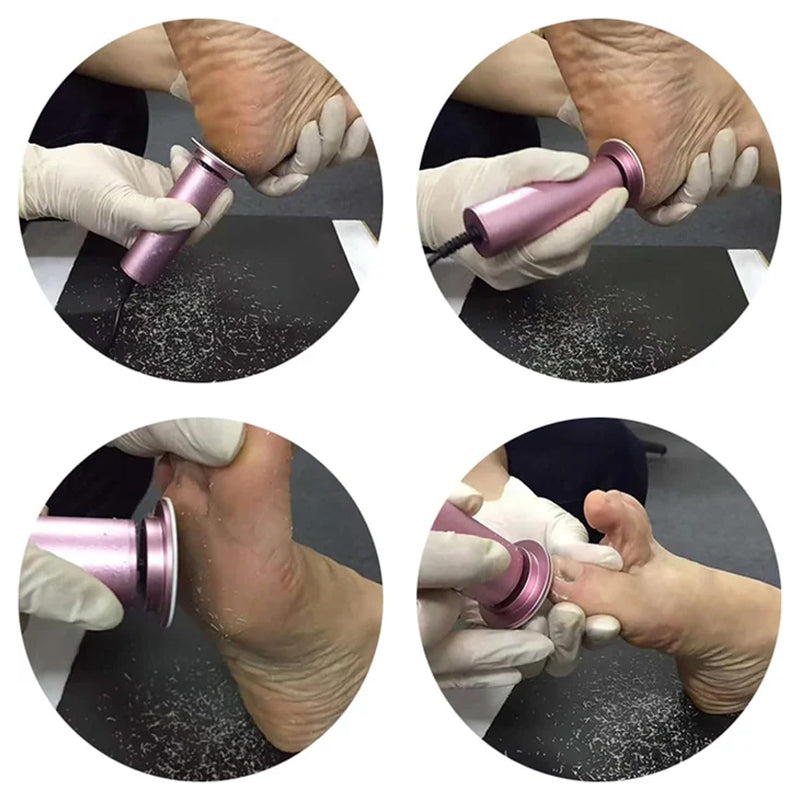Charly | Electric Foot Callus Remover with Adjustable Speed