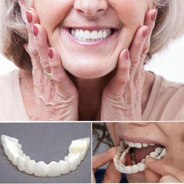 Charly | On Smile Veneers (Upper and Lower Jaw included)