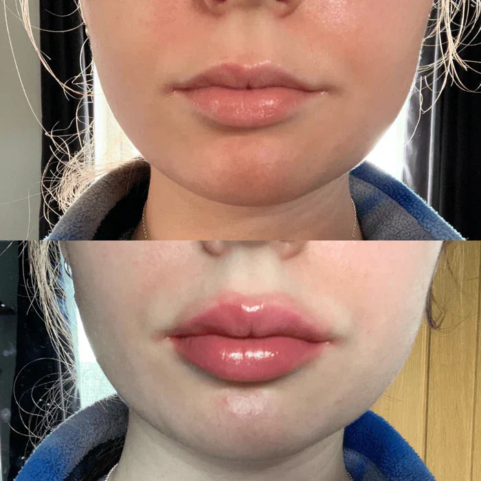 Instant Lip Plumping Serum