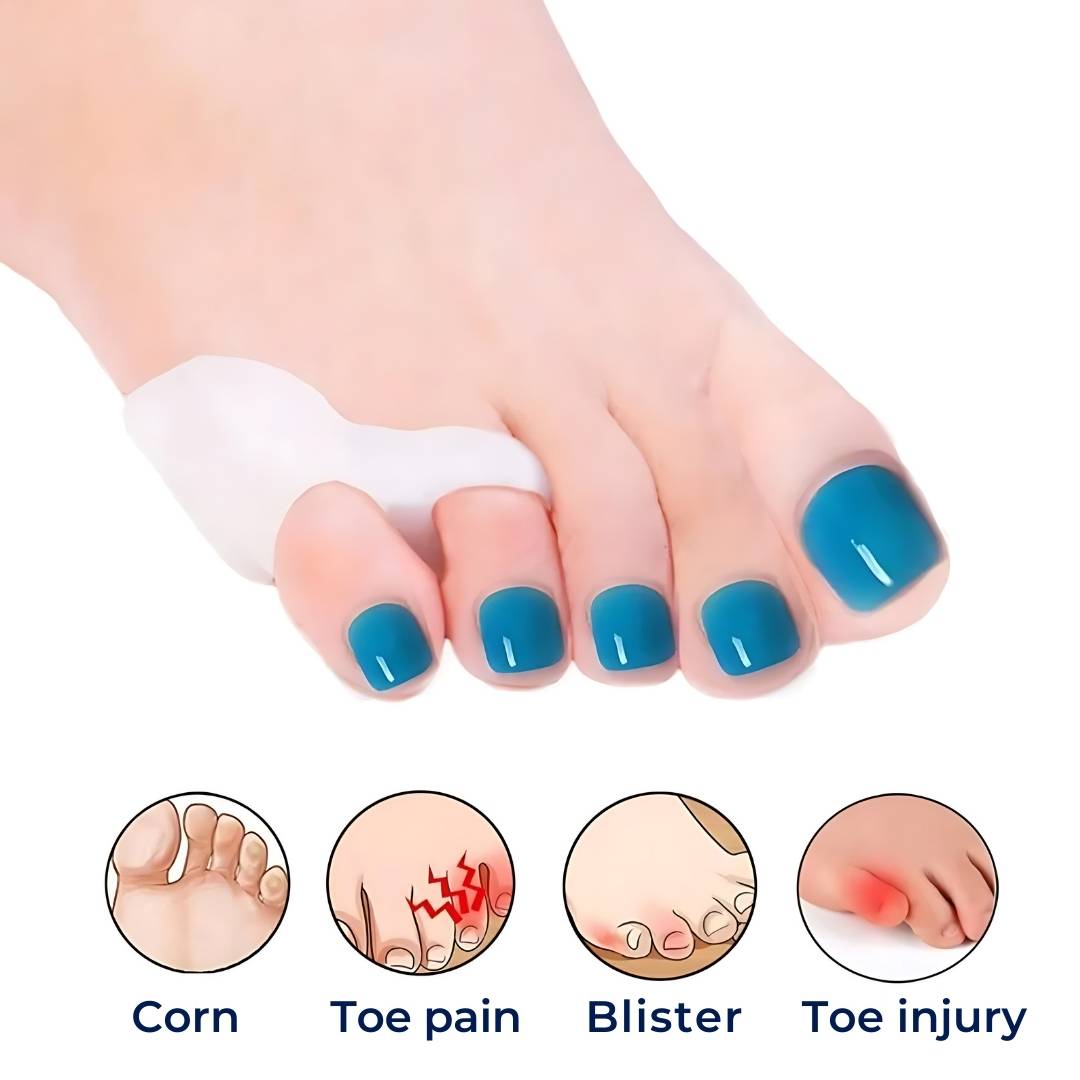 ToeGuard Orthopedic Toe Spacers | Bunionette Corrector - Little Toe Straightener - for Bunions - Hammertoe and Toe Alignment Charly